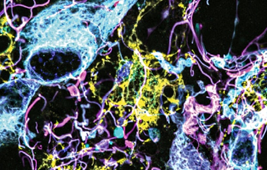 MIT and Brigham Researchers Unveil Breakthrough Brain Tumor Nanoimaging, Poised to Transform Diagnosis and Treatment