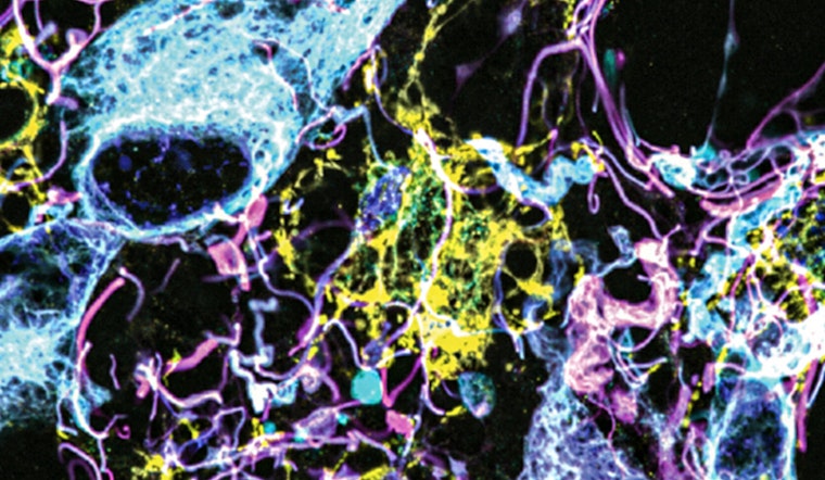 MIT and Brigham Researchers Unveil Breakthrough Brain Tumor Nanoimaging, Poised to Transform Diagnosis and Treatment