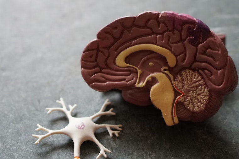 MIT and Cornell Study Links Language Issues to Early Dementia