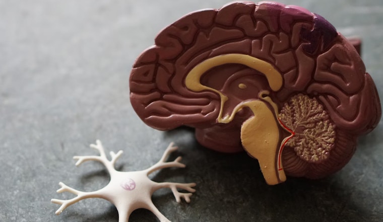 MIT and Cornell Study Links Language Issues to Early Dementia