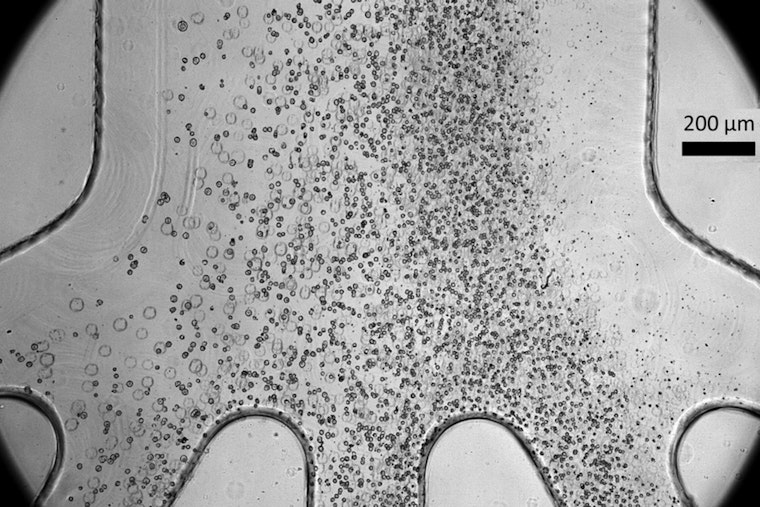 MIT Marvel, Cell-Sorting Chip Could Zap Tumor Threat in Life-Saving Therapies
