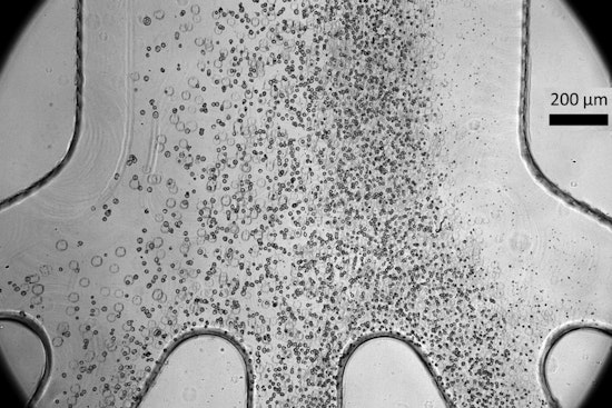 MIT Marvel, Cell-Sorting Chip Could Zap Tumor Threat in Life-Saving Therapies