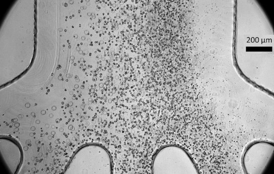 MIT Marvel, Cell-Sorting Chip Could Zap Tumor Threat in Life-Saving Therapies