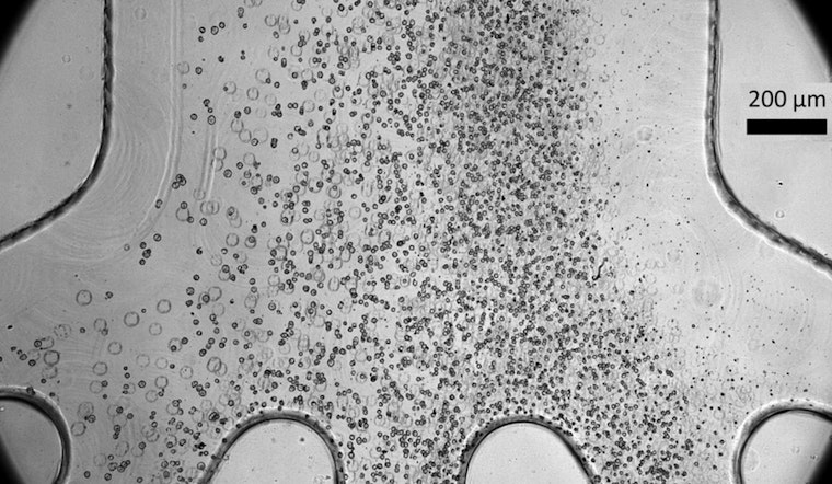 MIT Marvel, Cell-Sorting Chip Could Zap Tumor Threat in Life-Saving Therapies