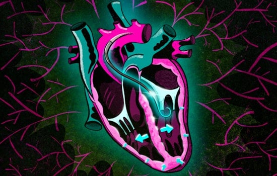 MIT Unveils Lifesaver Test for Heart Shock Victims, VAD Response Predictor Could Revolutionize Treatment