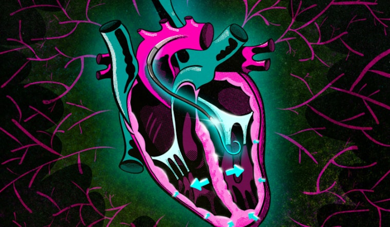 MIT Unveils Lifesaver Test for Heart Shock Victims, VAD Response Predictor Could Revolutionize Treatment