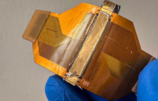MIT's Marvel, Wearable Ultrasound Sticker May Revolutionize Organ Health Tracking