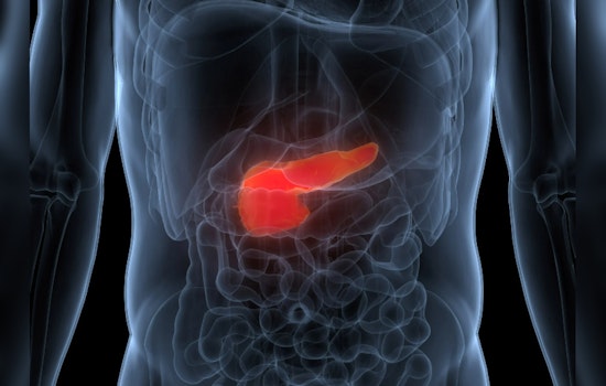 Predicting Pancreatic Peril: AI's Early Warning System Could Be a Lifesaver, Harvard Study Reveals