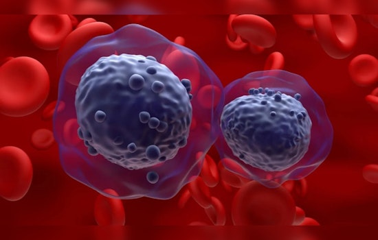 UT Austin's Eureka Moment: New Leukemia Treatment Strategy May Cut Cancer's 'Fuel Supply' Without Harming Healthy Cells