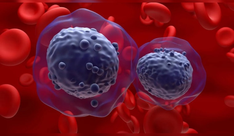 UT Austin's Eureka Moment: New Leukemia Treatment Strategy May Cut Cancer's 'Fuel Supply' Without Harming Healthy Cells