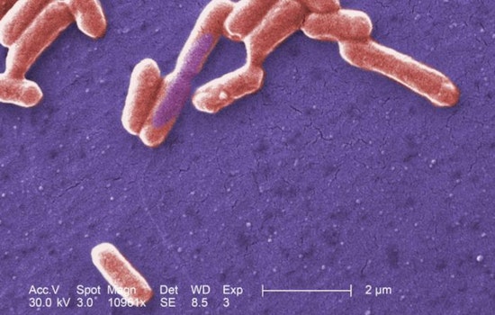 E. coli Outbreak in Seattle Linked to Guacamole from West Seattle PCC Community Markets