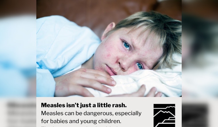 Measles Case Confirmed in Coconino County, Flagstaff on Alert for Potential Exposures at Five Locations