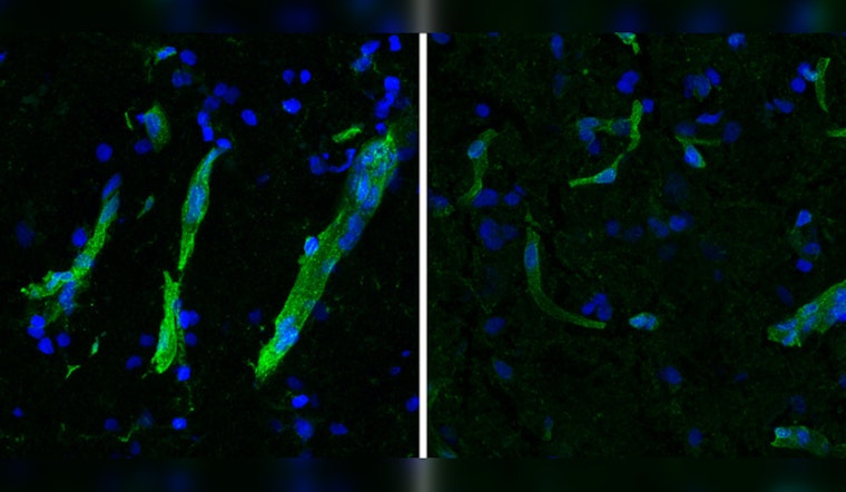 MIT and Mayo Clinic Study Reveals Potential Unified Treatment Path for ALS and FTLD