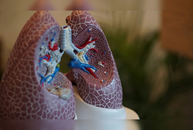 University of Minnesota Unveils Clues to Lung Scourge, Eyes Hope in ARDS Battle