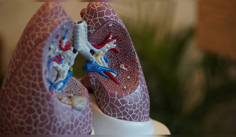 University of Minnesota Unveils Clues to Lung Scourge, Eyes Hope in ARDS Battle