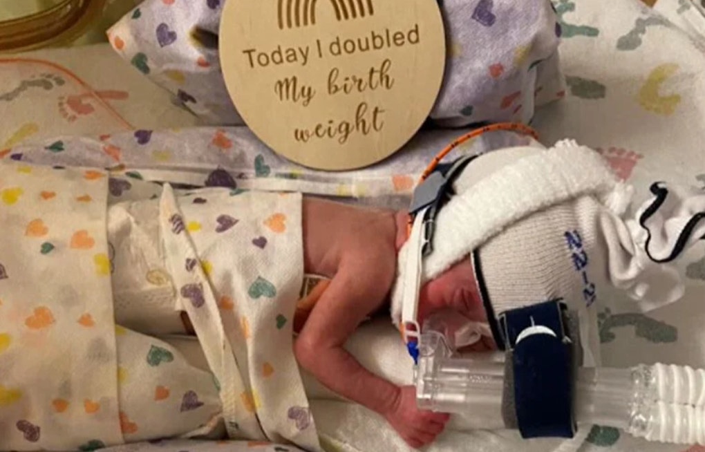 Washington Family Celebrates as 'Miracle Baby' Defies Odds, Ready to Leave Portland Hospital