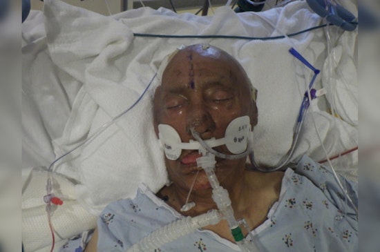 LA General Hospital Seeks Public's Help to Identify Unnamed Bicycle Crash Victim