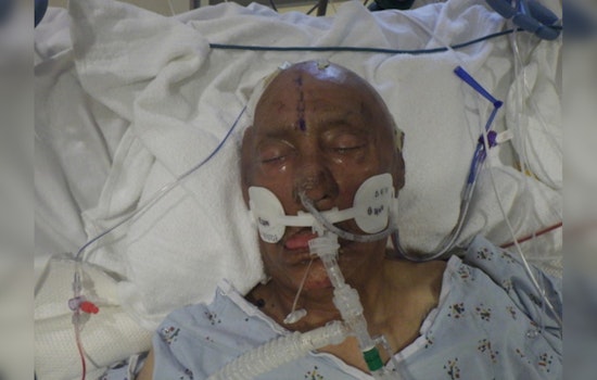 LA General Hospital Seeks Public's Help to Identify Unnamed Bicycle Crash Victim
