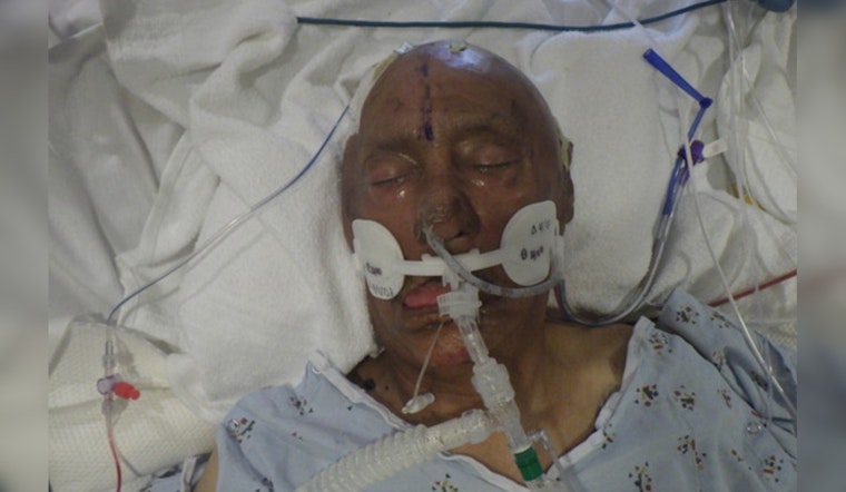 LA General Hospital Seeks Public's Help to Identify Unnamed Bicycle Crash Victim