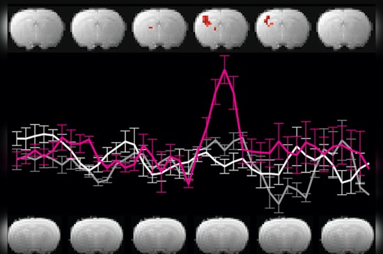 MIT Scientists Debunk Alleged Neuroimaging Breakthrough, Expose Inherent Flaws in DIANA MRI Technique