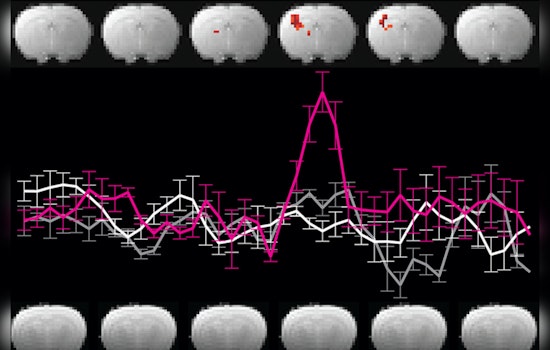 MIT Scientists Debunk Alleged Neuroimaging Breakthrough, Expose Inherent Flaws in DIANA MRI Technique