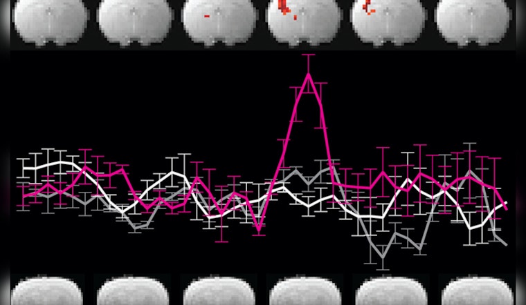 MIT Scientists Debunk Alleged Neuroimaging Breakthrough, Expose Inherent Flaws in DIANA MRI Technique