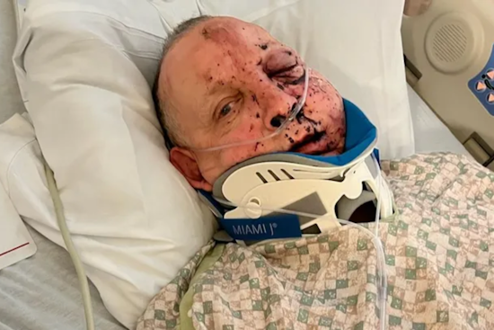 Portland Truck Driver Recovers After Turkey Smashes Through Windshield on I-5 Near Grants Pass