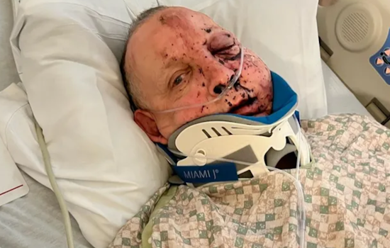 Portland Truck Driver Recovers After Turkey Smashes Through Windshield on I-5 Near Grants Pass