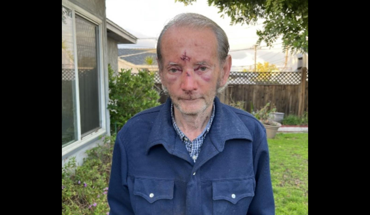 San Diego Police Seek Public's Help to Locate Missing 73-Year-Old Evan Ziegler