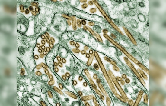 Texas Man Contracts Avian Flu in Rare Case Linked to Dairy Cattle, State Health Services Respond with Vigilance