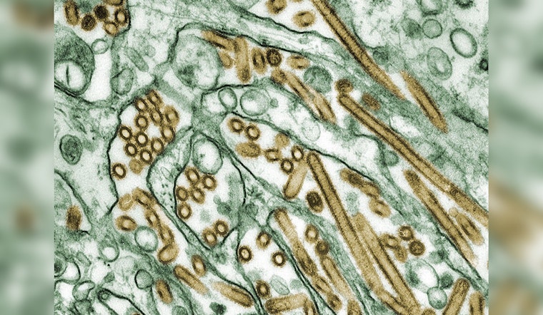 Texas Man Contracts Avian Flu in Rare Case Linked to Dairy Cattle, State Health Services Respond with Vigilance
