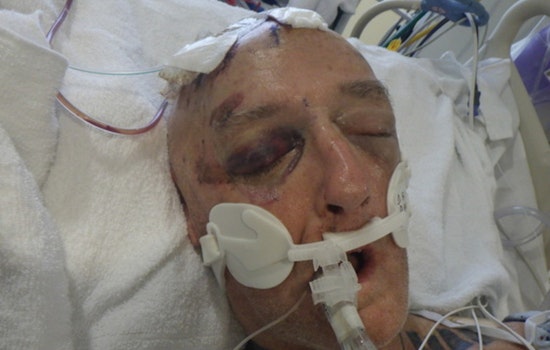 Los Angeles Hospital Seeks Public's Help in Identifying Mysterious Patient Found Unresponsive Downtown