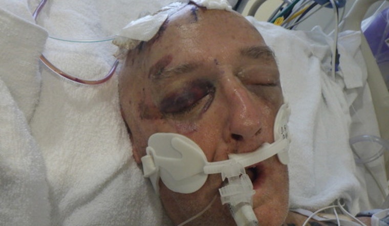 Los Angeles Hospital Seeks Public's Help in Identifying Mysterious Patient Found Unresponsive Downtown