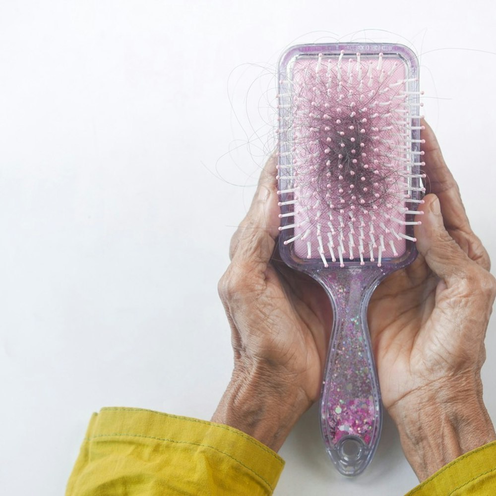 MIT, Harvard Med School Achieve Hair Restoration Breakthrough with Microneedle Patches