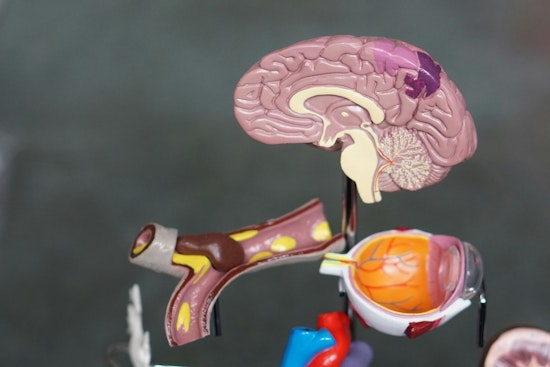 MIT Study Reveals How Early Visual Limitations Boost Brain's Object Recognition Abilities