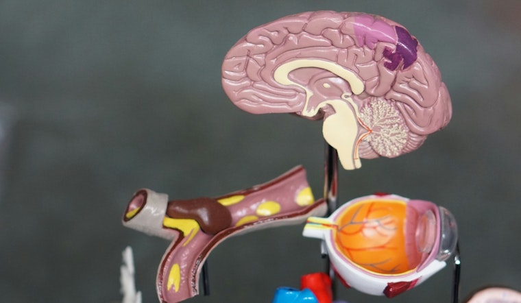 MIT Study Reveals How Early Visual Limitations Boost Brain's Object
