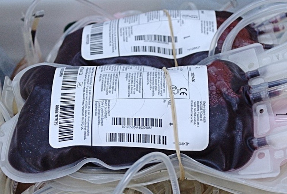 Rare Blood Type Patient Saved by Global Network of Donors and Healthcare Collaboration