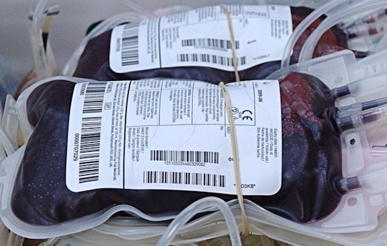 Rare Blood Type Patient Saved by Global Network of Donors and Healthcare Collaboration