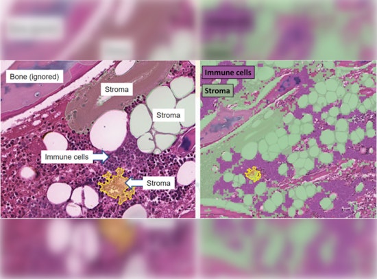 Scientists Unveil Detailed Cellular Atlas of Human Bone Marrow, Aiding Blood Disease Research