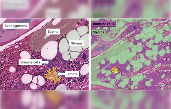 Scientists Unveil Detailed Cellular Atlas of Human Bone Marrow, Aiding Blood Disease Research