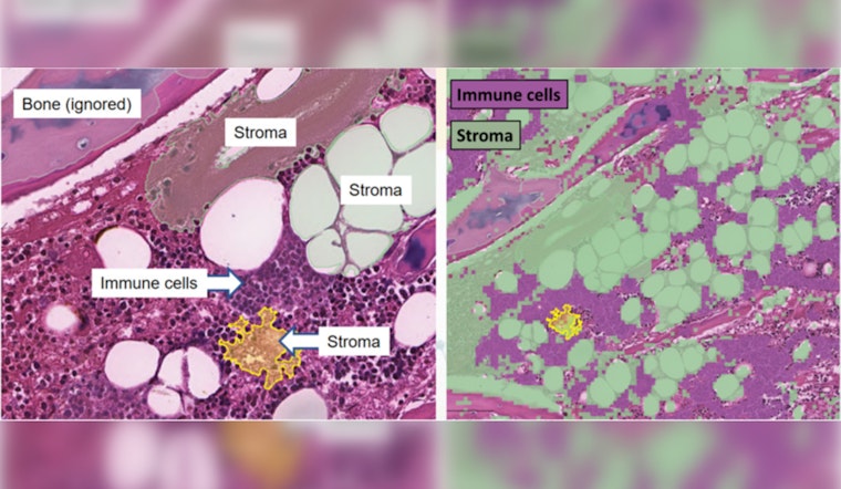 Scientists Unveil Detailed Cellular Atlas of Human Bone Marrow, Aiding Blood Disease Research