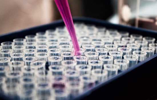 SMART's RNA Riddle Solved as Scientists Corner Malaria's Drug Dodging Tactics