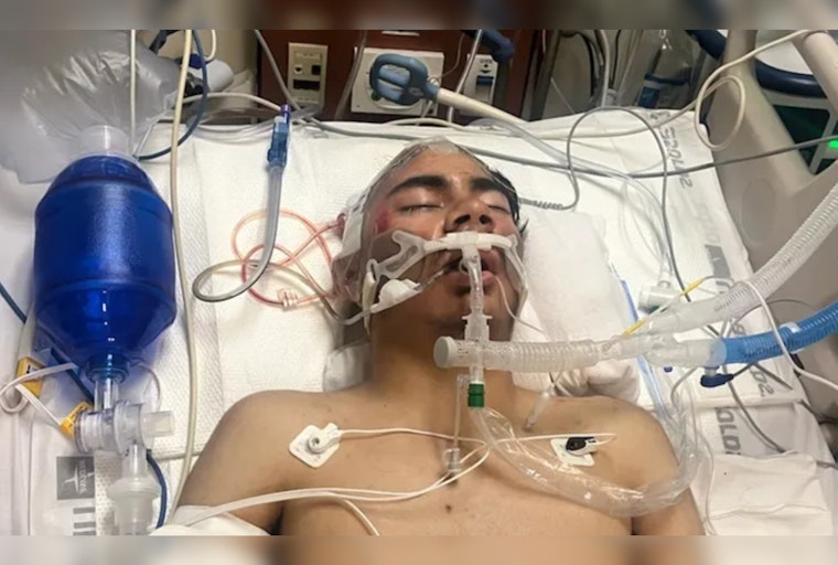 Teen in Critical Condition after Unprovoked Attack at Watts Restaurant