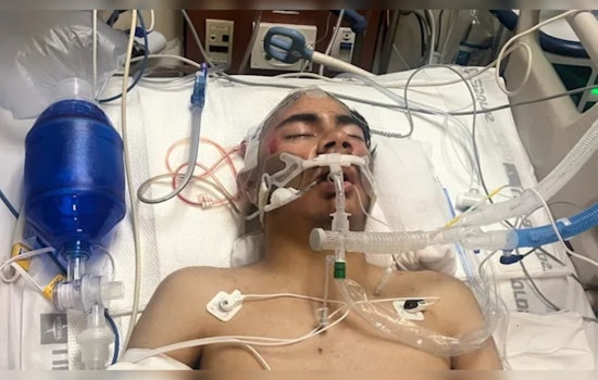 Teen in Critical Condition after Unprovoked Attack at Watts Restaurant