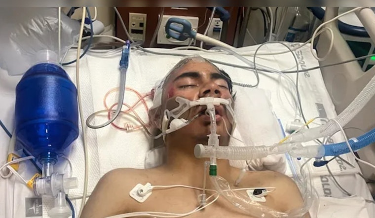Teen in Critical Condition after Unprovoked Attack at Watts Restaurant