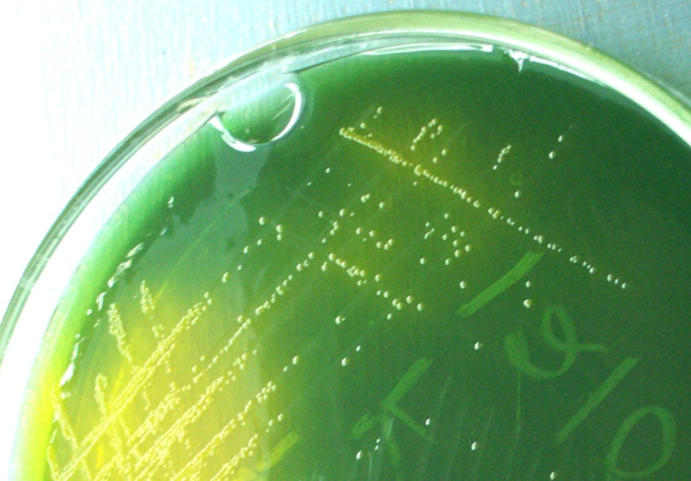 UT Austin Scientists Unravel How Cholera Strain Eludes Evolution, Aiding Global Pandemic Fight