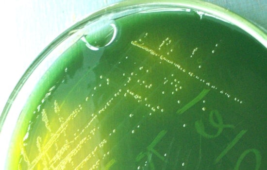 UT Austin Scientists Unravel How Cholera Strain Eludes Evolution, Aiding Global Pandemic Fight