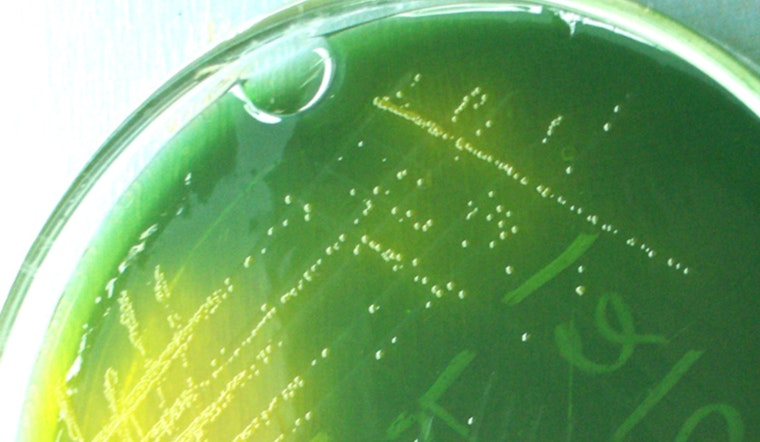 UT Austin Scientists Unravel How Cholera Strain Eludes Evolution, Aiding Global Pandemic Fight