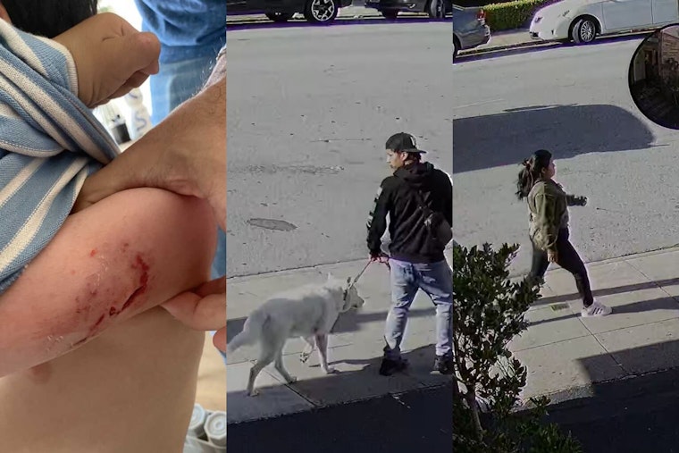 BREAKING VIDEO: Toddler Brutally Injured in Dog Attack near San Francisco Preschool; Dog Owners At-Large