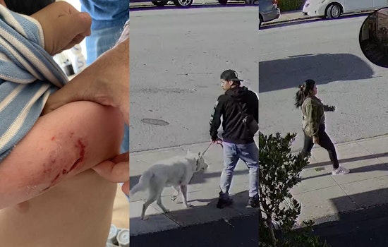 BREAKING VIDEO: Toddler Brutally Injured in Dog Attack near San Francisco Preschool; Dog Owners At-Large